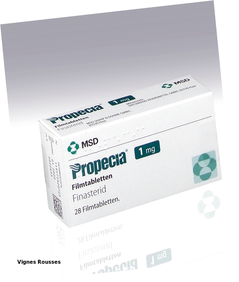 Propecia générique finastéride